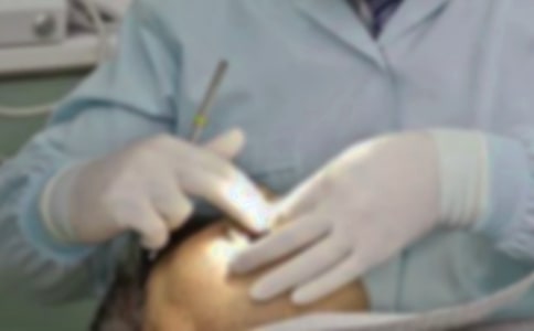 拔牙记作文【合集】