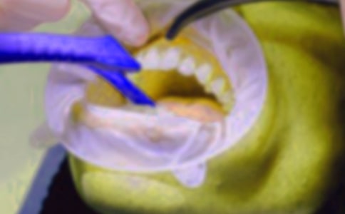 拔牙记小学作文