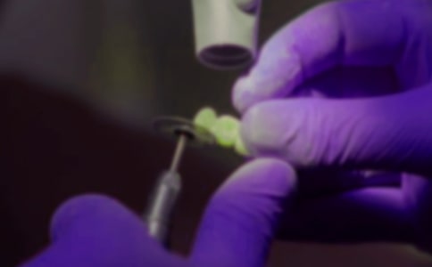 第一次拔牙作文