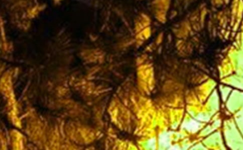 ���ֵ�Ԥ�����ĵ����