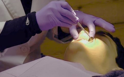 关于拔智齿文案